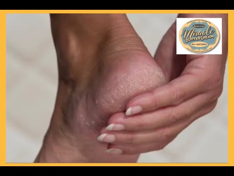 Peppermint Foot Moisturizer